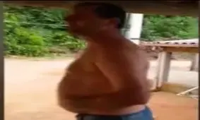 فیلم / پیوند عجیب دست مردی به داخل شکمش!