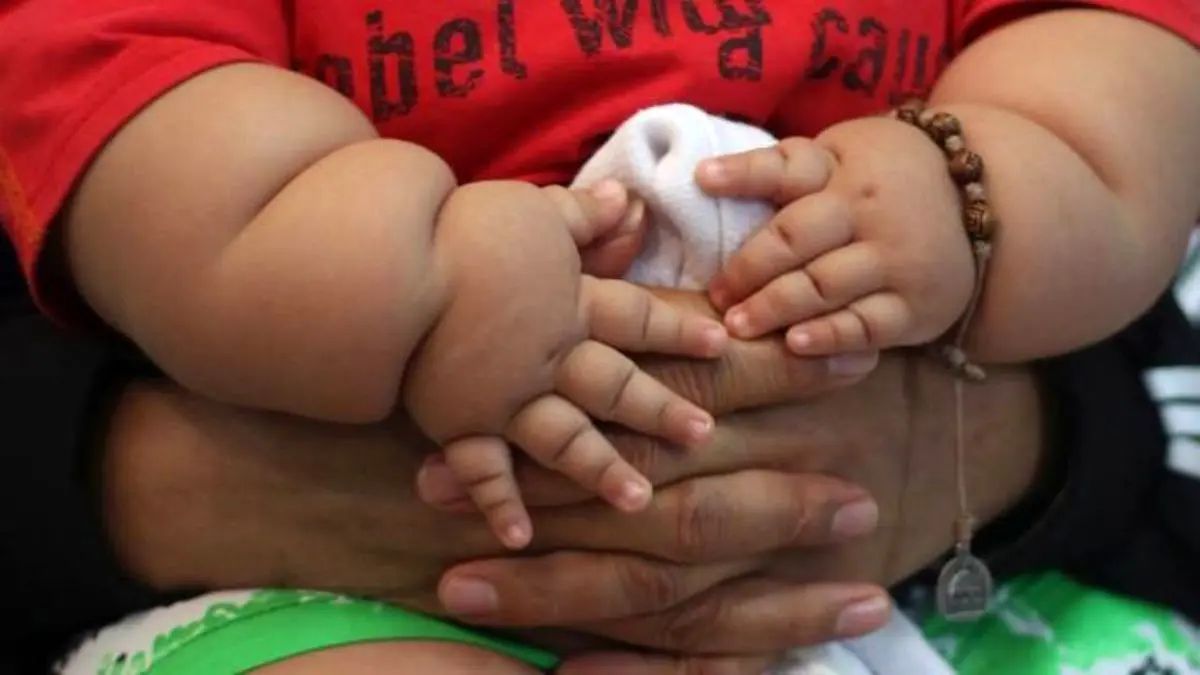 چاقی در کودکان خطر ابتلا به بیماری ام‌اس را افزایش می‌دهد