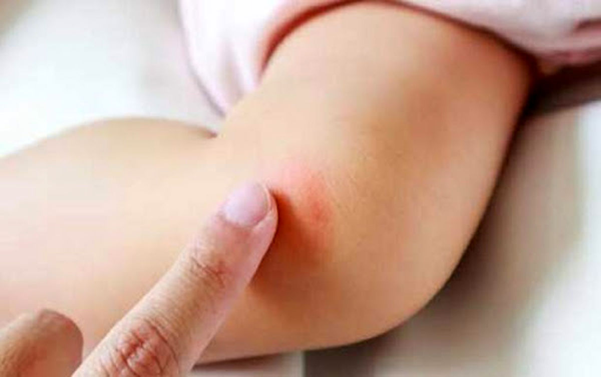چکار کنیم تا کمتر عرق سوز شویم؟