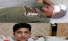 هزینه‌های درمان کولبر ۱۴ ساله تامین شد