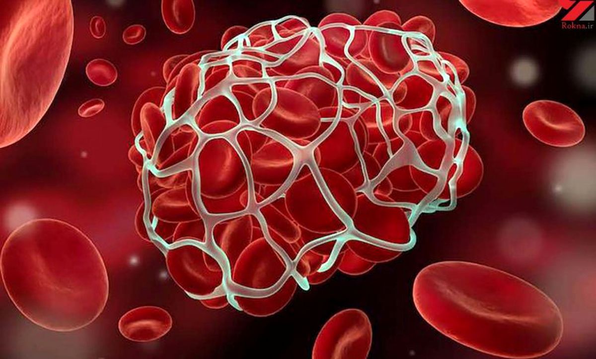 دلایل و عوامل خطر برای لخته‌های خون