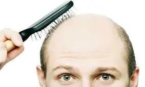 بهترین مواد غذایی برای تقویت مو‌های شما