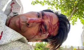 تازه‌ترین عکس امیرحسین صادقی در بیمارستان