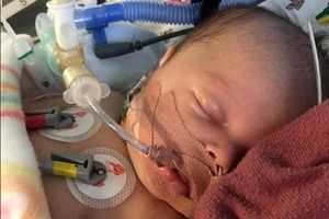 نجات معجزه‌آسای نوزاد ۱۷ روزه که با قطره‌ای شیر دچار سه ایست قلبی شد/ عکس