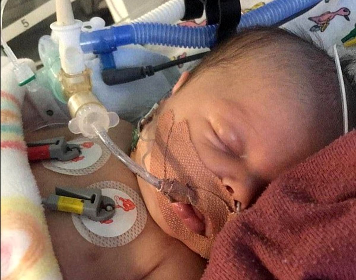 نجات معجزه‌آسای نوزاد ۱۷ روزه که با قطره‌ای شیر دچار سه ایست قلبی شد/ عکس