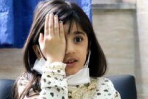 ارزیابی تنبلی چشم کودکان استان سمنان تا پانزدهم مهر ادامه دارد