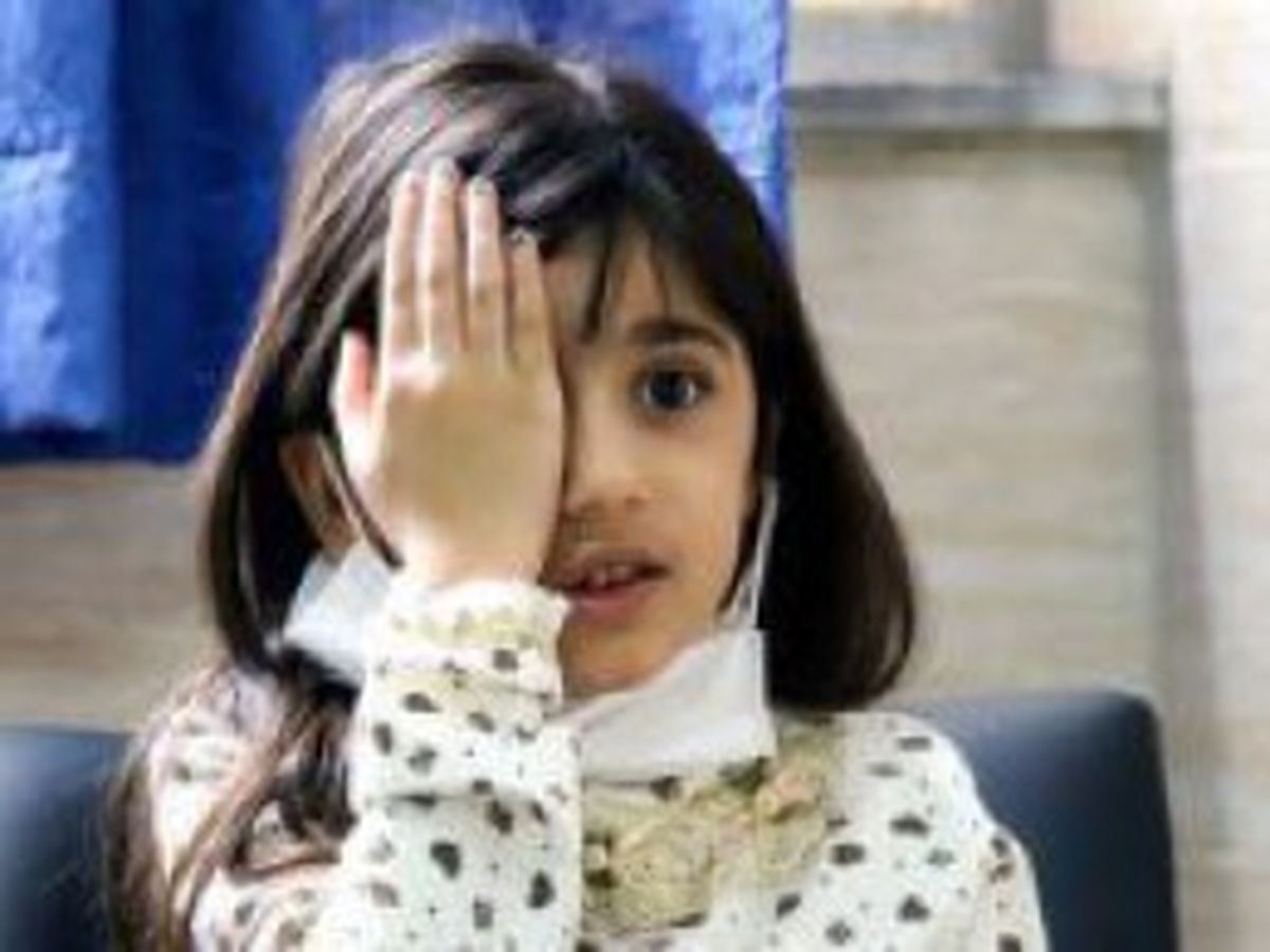 ارزیابی تنبلی چشم کودکان استان سمنان تا پانزدهم مهر ادامه دارد
