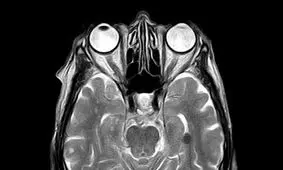 اثرات خطرناک خفیف‌ترین ضربات مغزی بر عملکرد مغز
