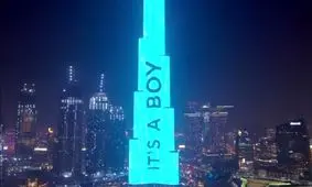 سونوگرافی لاکچری در برج خلیفه/ ویدئو