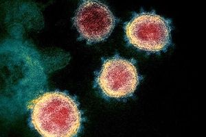 چرا کرونا مانند آنفلوآنزا یک ویروس فصلی نیست؟