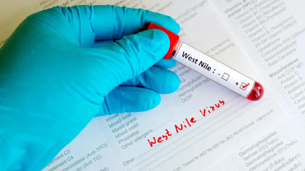 شیوع ویروسی نام ‌آشنا در اسپانیا