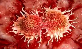 کشنده‌ترین سرطان کدام است؟