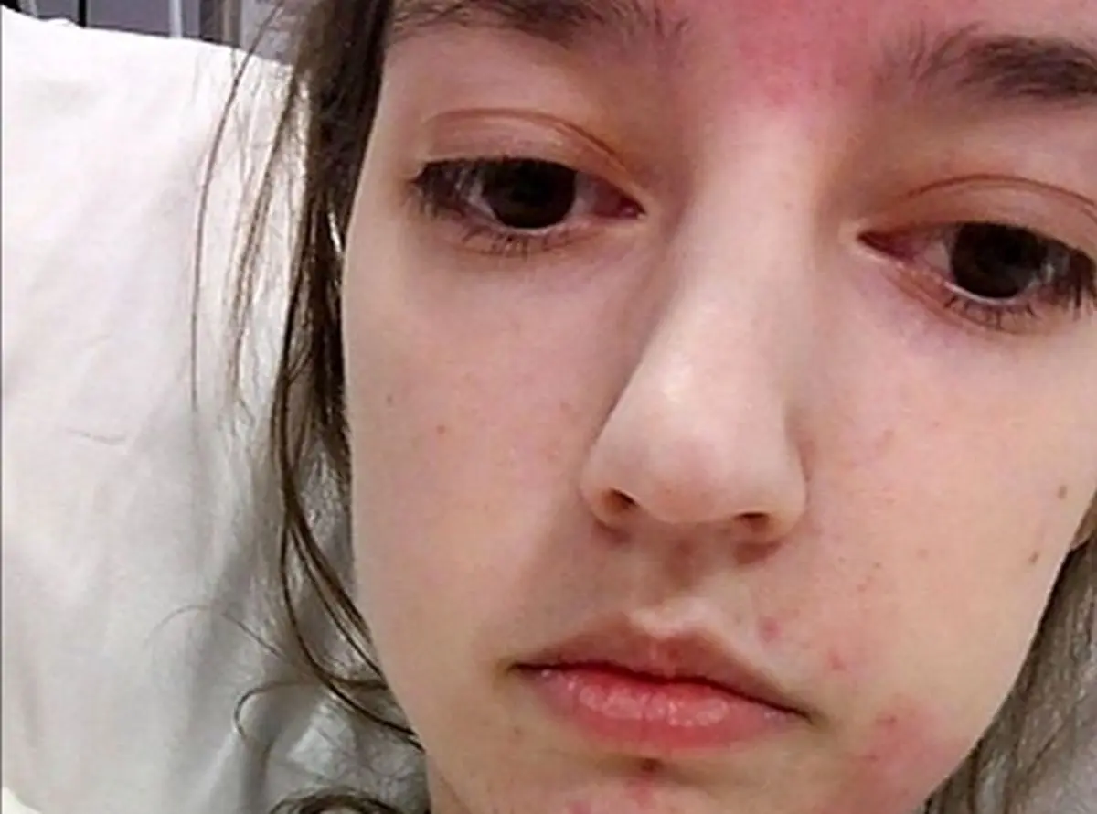 دختری با بیماری عجیب که غذا را از طریق قلبش می‌خورد/ عکس