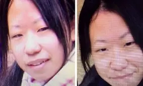 حیرت کاربران از تغییر چهره دختر ژاپنی پس از جراحی پلاستیک!