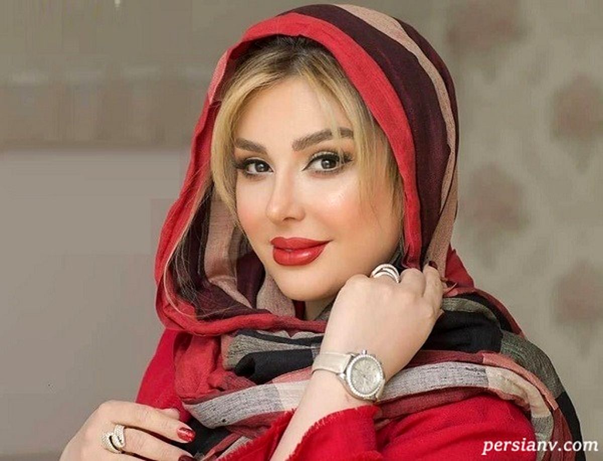 نیوشا ضیغمی بعد از عمل بینی دوم: خیلی رنج کشیدم
