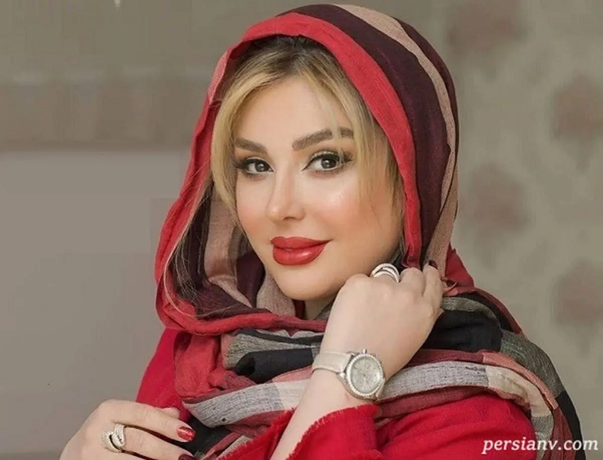 نیوشا ضیغمی بعد از عمل بینی دوم: خیلی رنج کشیدم
