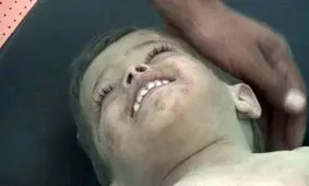 تصویری تکان دهنده از لبخند کودک یمنی پس از شهادت