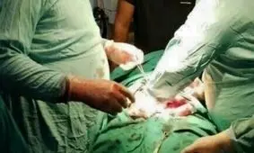 حیرت پزشکان از علت عجیب معده‌درد یک بیمار/ عکس