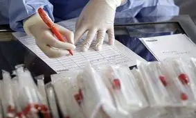 کدام تست کرونا مطمئن‌تر است/ هشدار در مورد سی تی اسکن ریه