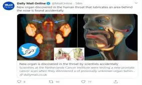 کشف عضو جدیدی در بدن به طور تصادفی