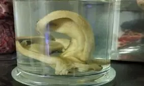 اقدام عجیب جوانی که دوست داشت سرش همانند جمجمه شود