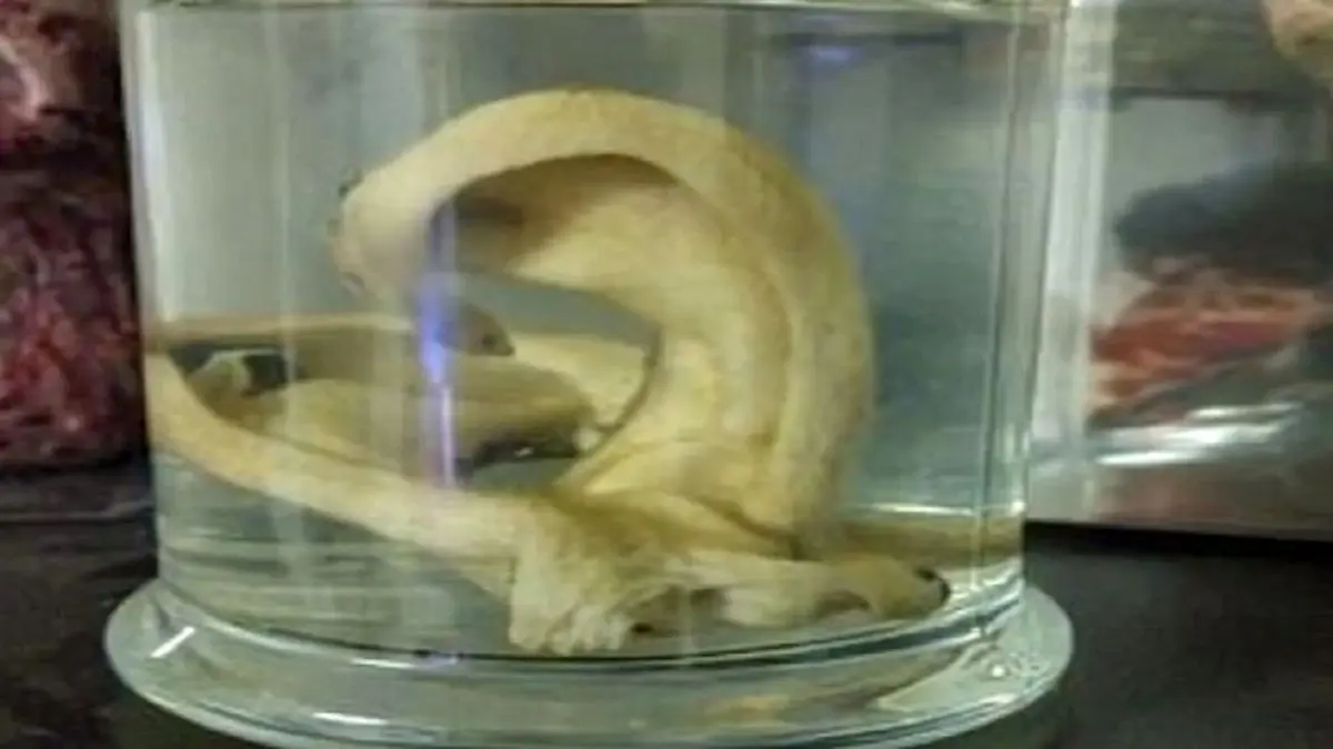 اقدام عجیب جوانی که دوست داشت سرش همانند جمجمه شود