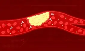 علت لخته شدن خون بیماران مبتلا به کرونا کشف شد