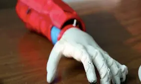 ابداع بازوی مصنوعی خورشیدی برای یک پسر ۸ ساله