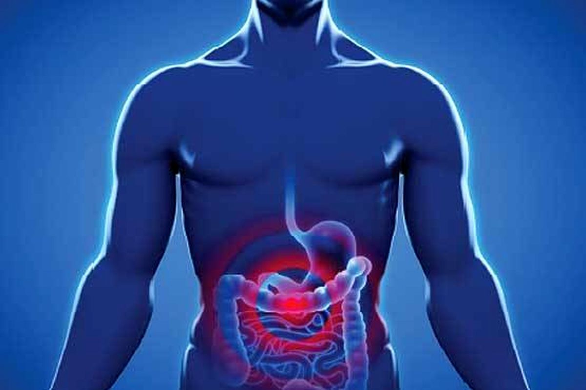 تاثیر سندروم روده تحریکپذیر بر رابطه جنسی