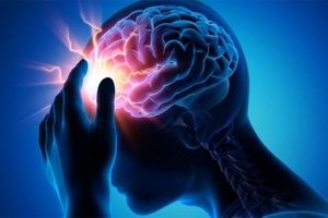 کرونا با بدترین عوارض سکته مغزی مرتبط است