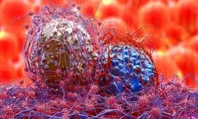 درمان سرطان‌های مقاوم به دارو با نانو داروی جدید