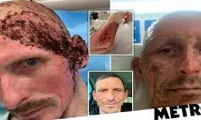 مواد ضدعفونی بلای جان راننده تاکسی شد