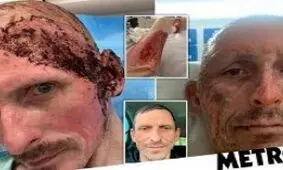 مواد ضدعفونی بلای جان راننده تاکسی شد