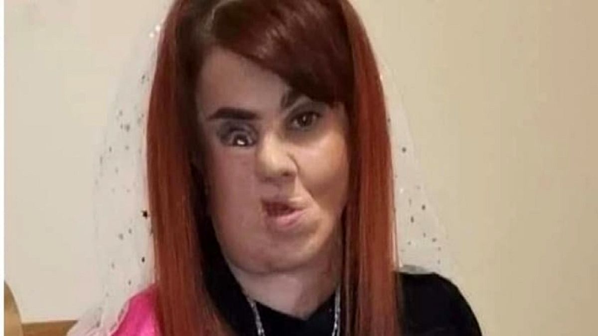 برخورد زننده مهمانان با عروس به خاطر چهرهاش/ عکس
