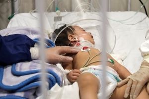 بستری روزانه حدود ۶ تا ۱۰ کودک مبتلا به کرونا در مشهد