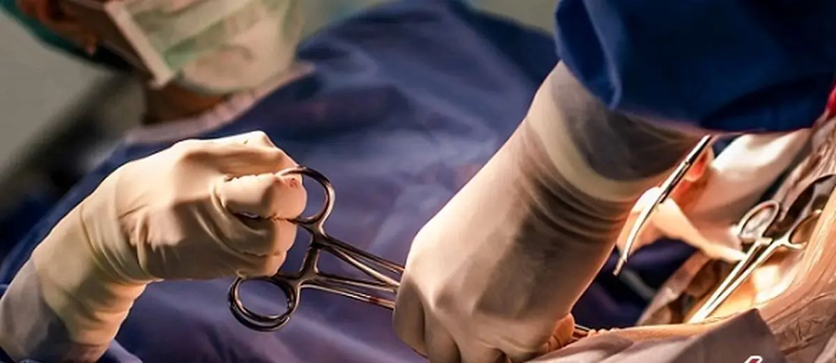 شبیه سازی سزارین در یوتیوب حاشیه ساز شد