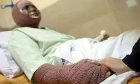 اسید پاشی به صورت خانم جوان / متهم بازداشت شد