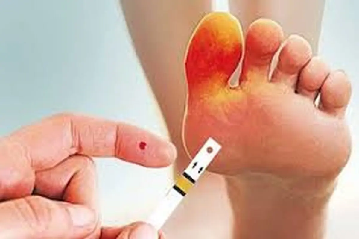 هر ۲۰ ثانیه، یک پای دیابتی قطع می‌شود