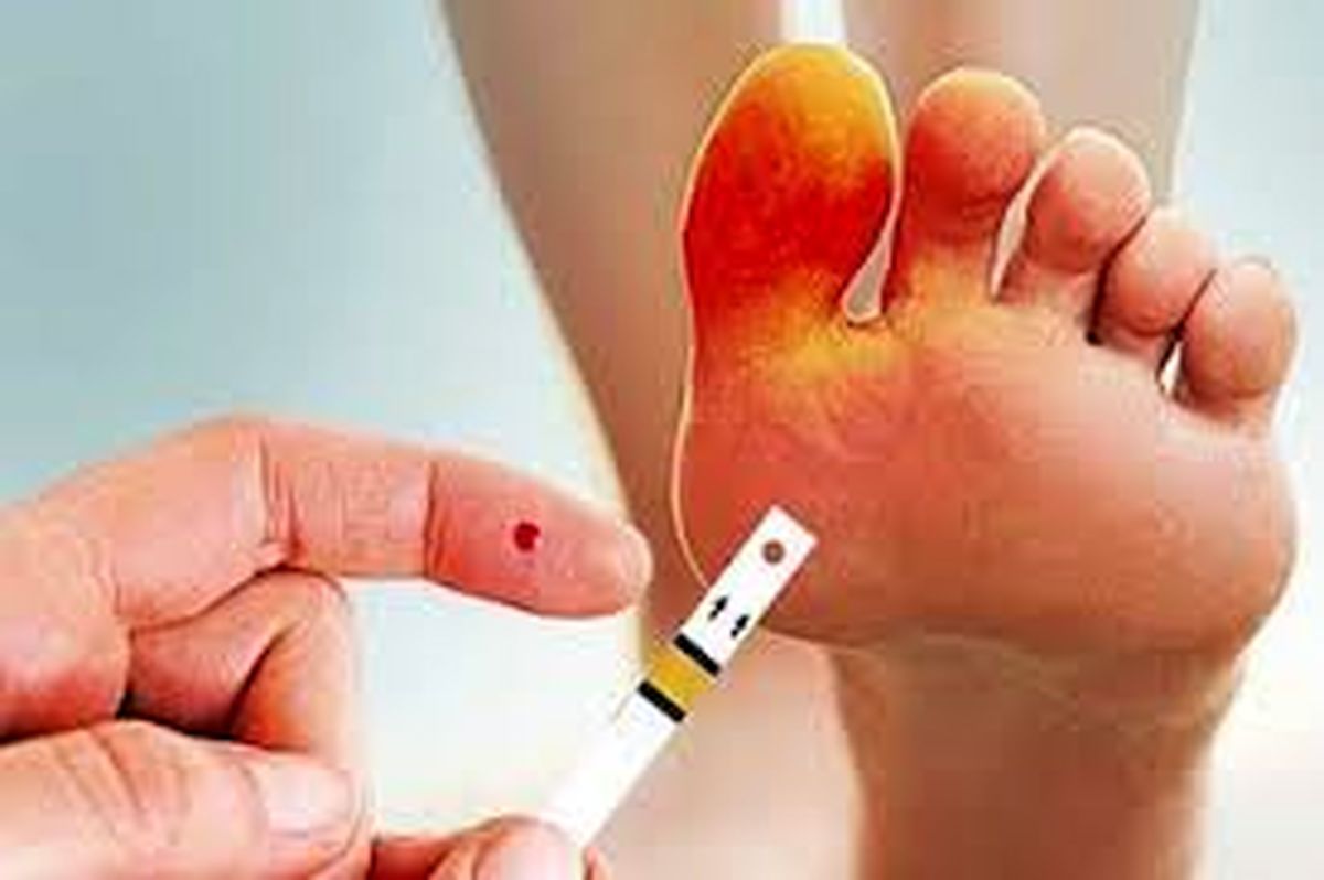 هر ۲۰ ثانیه، یک پای دیابتی قطع میشود
