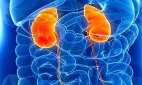 افزایش خطر بیماری کلیه با دو عادت بدِ غذایی