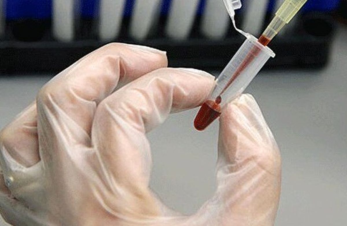 ۱۲۰ نمونه خون بند ناف نوزادان در استان سمنان ذخیره شد