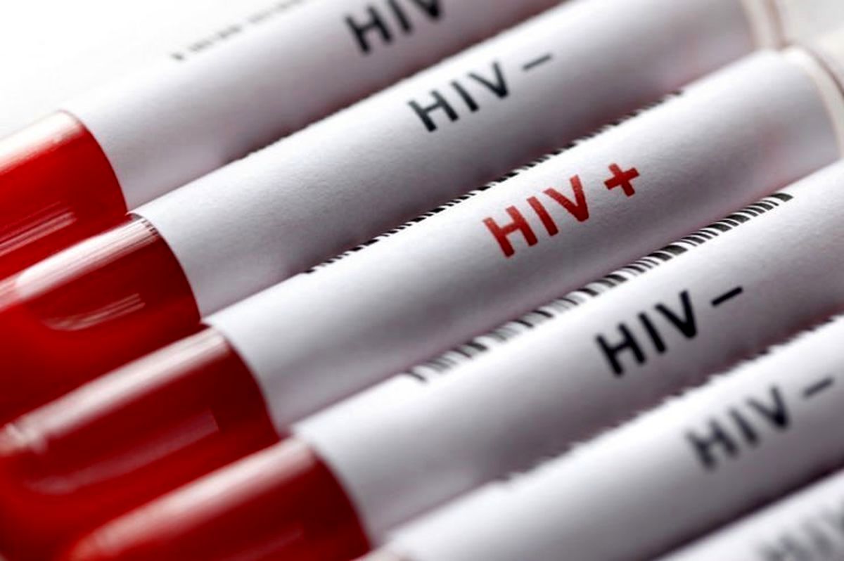 مینو محرز: مبتلایان به ایدز کمتر کرونا می‌گیرند
