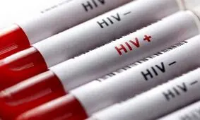 سرعت ابتلا به HIV در زنان ایرانی بیشتر از مردان است