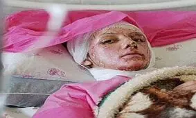 محکومیت 3 فرماندار در رابطه با تخلفات انتخاباتی/ قربانیان اسیدپاشی اصفهان دیه دریافت می‌کنند