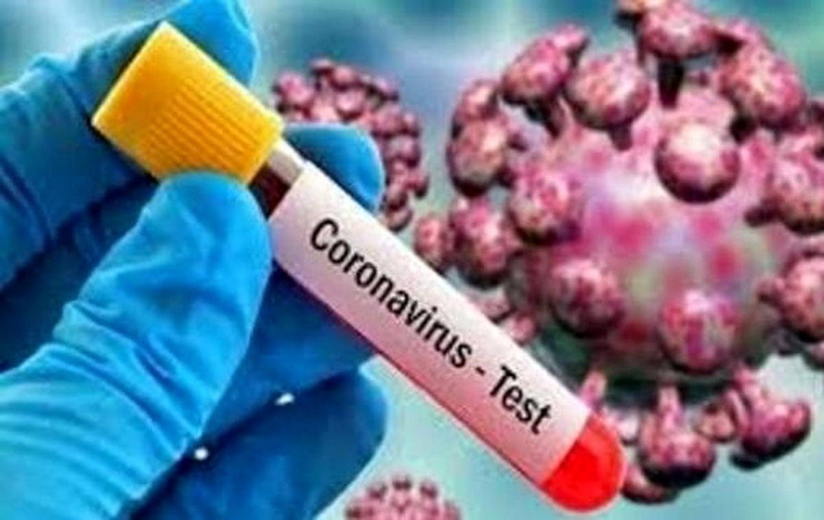 عضو کمیته علمی کرونا: مبتلایان ایدز، کمتر گرفتار کرونا می شوند