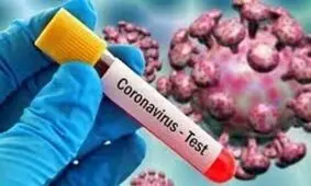 عضو کمیته علمی کرونا: مبتلایان ایدز، کمتر گرفتار کرونا می شوند