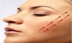 تاثیر تلفن همراه روی پوست صورت