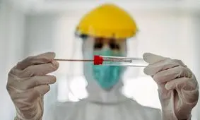 بهترین زمان برای انجام تست pcr و سی‌تی اسکن چند روز بعد از ایجاد علائم است؟