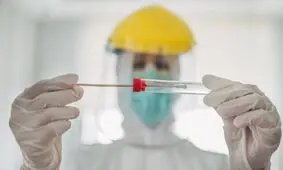 بهترین زمان برای انجام تست pcr و سی‌تی اسکن چند روز بعد از ایجاد علائم است؟