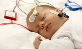 غربالگری شنوایی ۶۳ هزار نوزاد در آذربایجان شرقی